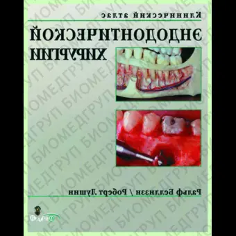 Клинический атлас эндодонтической хирургии / Р. Беллиззи