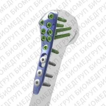 Компрессионная костная пластина плечевая кость Alians