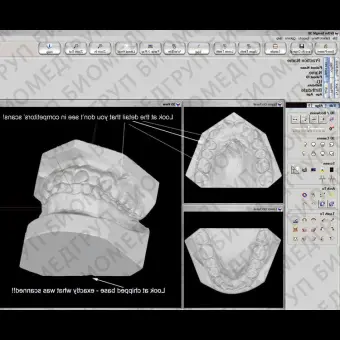 Программное обеспечение для стоматологических лабoраторий Ortho Insight 3D Full / Lite