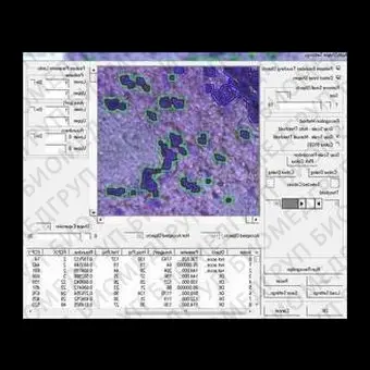 Медицинское программное обеспечение LMD