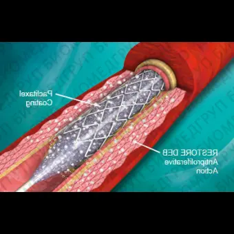 Стент для коронарных артерий Precision
