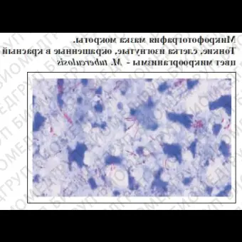 Набор красителей для окрашивания кислотоустойчивых микроорганизмов 1 набор ФСЗ 2009/03635