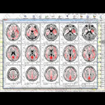 ЭЭГсистема 32 канала NEURONSPECTRUM5