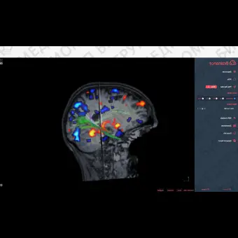 Программное обеспечение для МРТ Brainance MD