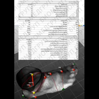 Система оценки походки Dynamic FootMorphology