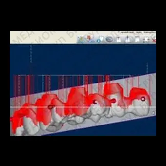 Программное обеспечение для стоматологии CORITEC ICAM V5