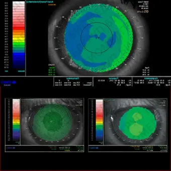 Tomey TMS5 Корнеотопограф