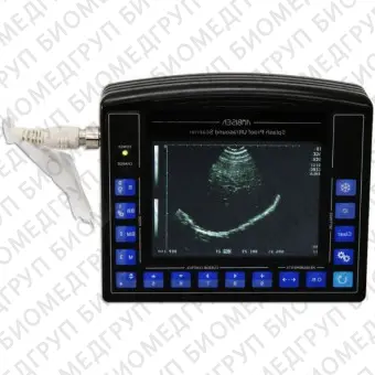 Переносной ультразвуковой сканер AV2100