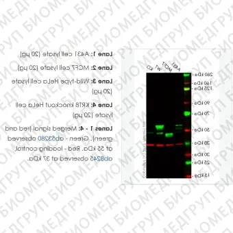 Лизат нокаутных клеток KRT8 knockout HeLa cell lysate, Abcam, ab263785, 100 мкг