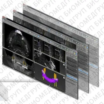 Программное обеспечение для стоматологической имплантологии coDiagnostic