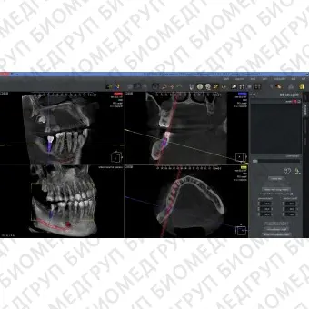 Программное обеспечение для обработки снимков зубов QuickVision 3D