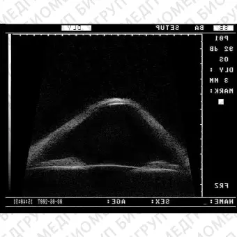 Переносной ультразвуковой сканер MD320W UBM