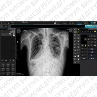 Redikom Premium Рентгеновский диагностический комплекс
