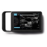 Портативный ультразвуковой сканер SonoSite iVIZ