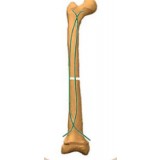 Интрамедуллярный штифт бедренная кость FLEX NAIL™