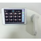 Переносной сканер мочевого пузыря BProbe-2