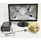 Монитор для эндоскопии Abc-lap Insight