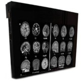 Double Black Imaging 24″ MRSafe Display Медицинский монитор