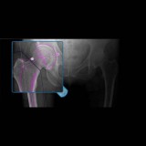 Медицинское программное обеспечение OrthoView